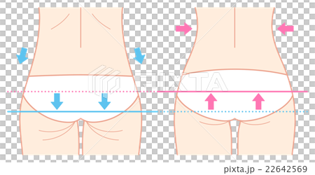 ヒップのビフォーアフター（矢印付き、繊細） 22642569