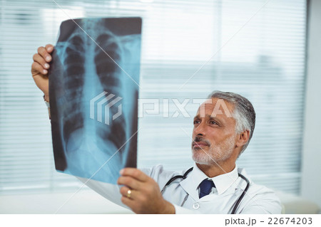 Doctor checking a x-ray report Doctor checking a x-ray report 22674203