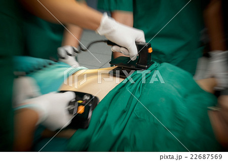 Defibrillator practice on a CPR with motion blur 22687569