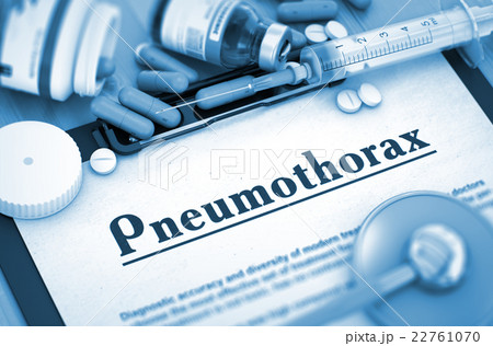 Pneumothorax Diagnosis. Medical Concept. Pneumothorax Diagnosis. Medical Concept. 22761070