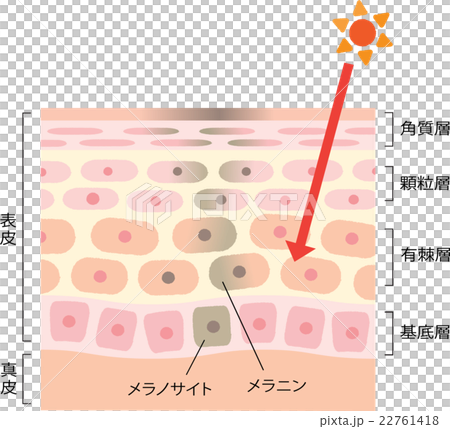 しみ 肌のメカニズム しみ 肌のメカニズム 22761418