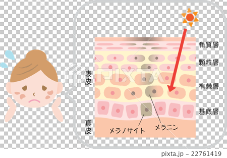 しみ 肌 女性 しみ 肌 女性 22761419