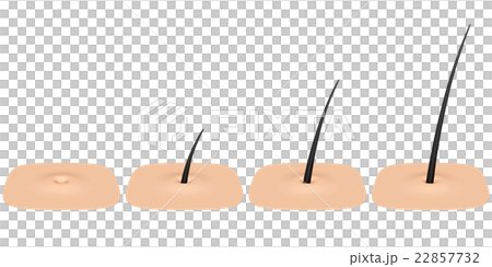 肌　毛穴 22857732