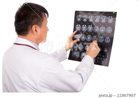Asian neurology doctor examining head MRI images Asian neurology doctor examining head MRI images 22867907