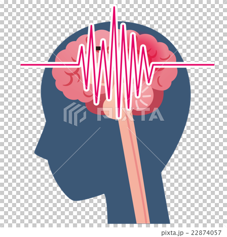 頭痛 脳梗塞 脳の病気 頭痛 脳梗塞 脳の病気 22874057