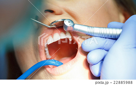 Woman getting a dental treatment 22885988