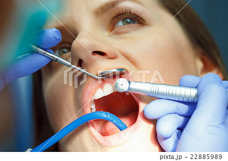 Woman getting a dental treatment 22885989