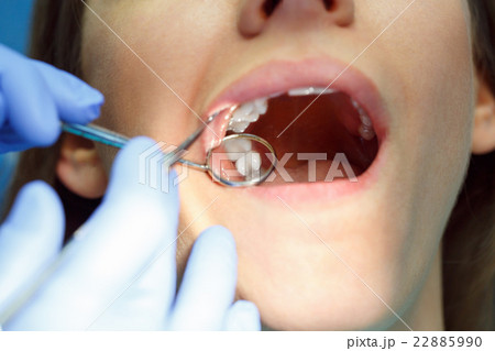 Woman getting a dental treatment 22885990