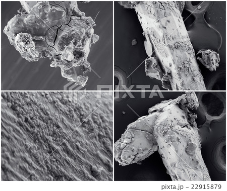 Scientific collage. Photo from electron microscope Scientific collage. Photo from electron microscope 22915879