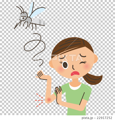 蚊に刺される女性 22917252