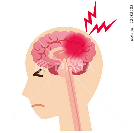頭痛 脳梗塞 脳の病気のイラスト素材