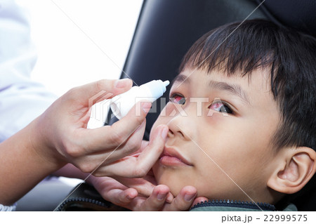 Closeup of doctor pouring eye drops in eye patient 22999575