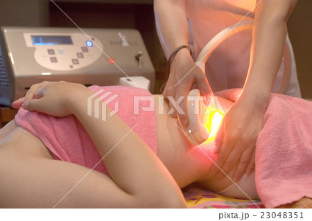 レーザー脂肪除去 23048351