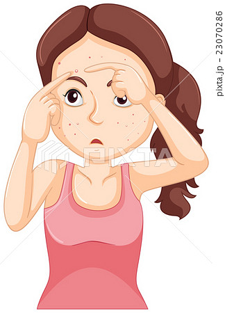 Teenager girl squeezing zit 23070286