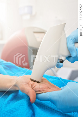 Procedure against hyperhidrosis 23092457