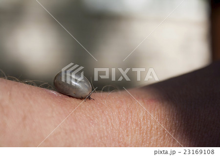 tick on hand 23169108