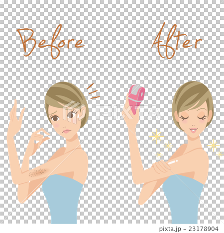 Waste hair treatment 23178904