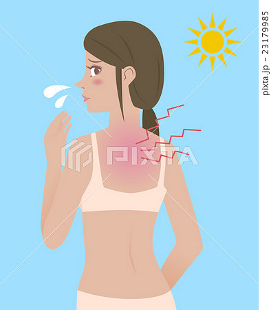 女性と日焼け 女性と日焼け 23179985