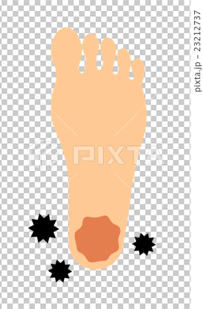 腳跟運動員的腳 腳跟運動員的腳 23212737