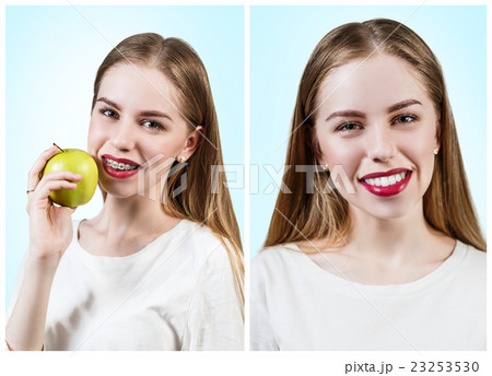Young woman with brackets on teeth eating apple 23253530