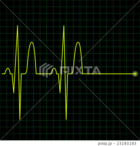 Electronic Graph In Yellow Colorのイラスト素材 2321