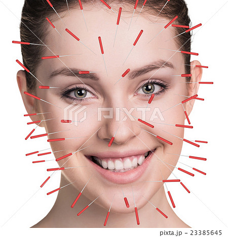 Close-up of performing acupuncture therapy on face 23385645