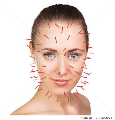 Close-up of performing acupuncture therapy on face Close-up of performing acupuncture therapy on face 23385654