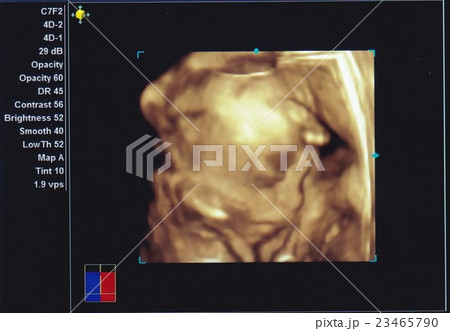 赤ちゃんエコー　妊娠26週 23465790