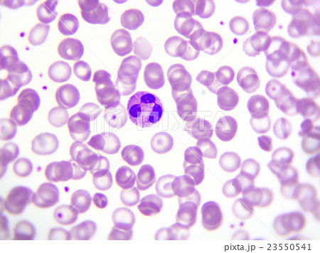 White blood cell in peripheral blood smear 23550541