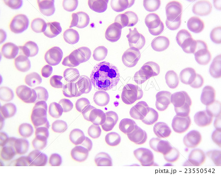 White blood cell in peripheral blood smear White blood cell in peripheral blood smear 23550542