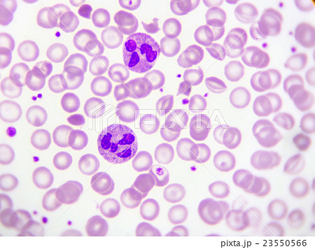 Neutrophil cell in blood smear Neutrophil cell in blood smear 23550566
