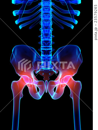 Hip painful skeleton x-ray, 3D illustration. 23579265