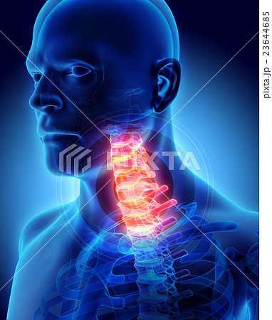 Neck painful - cervica spine, 3D illustration. Neck painful - cervica spine, 3D illustration. 23644685