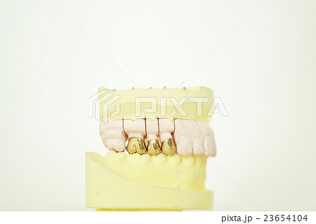 歯形態 23654104