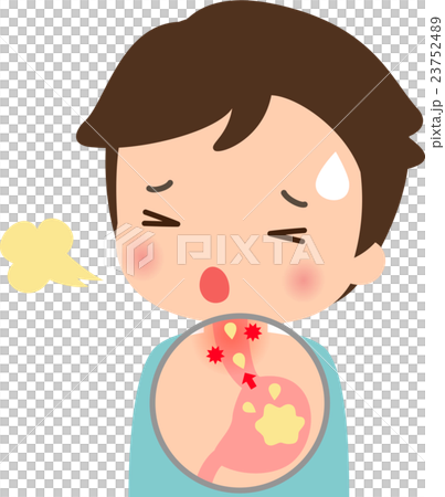 Men suffering from reflux esophagitis Men suffering from reflux esophagitis 23752489
