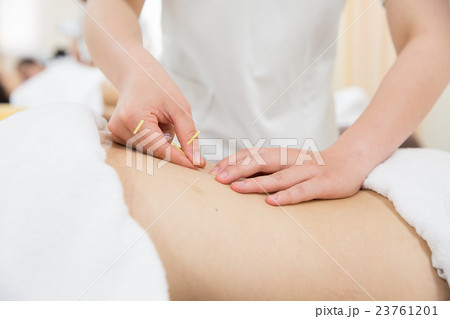 鍼治療　イメージ 23761201