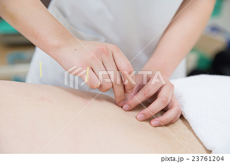 鍼治療　イメージ 23761204
