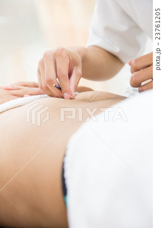 お灸治療イメージ 23761205