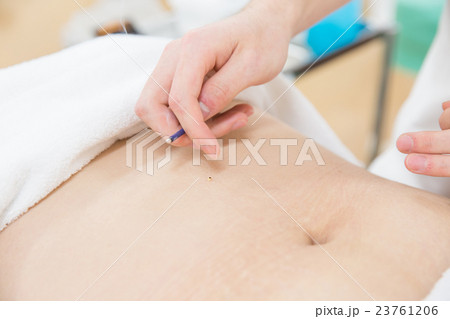 お灸治療イメージ 23761206
