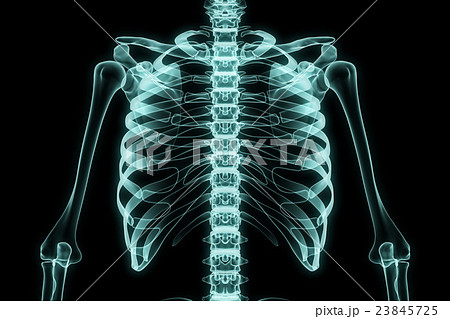 X-ray Chestのイラスト素材 [23845725] - PIXTA