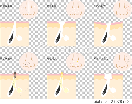 毛穴 鼻 毛穴 鼻 23920530