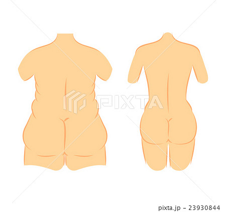 Butt lift correction waist line 23930844