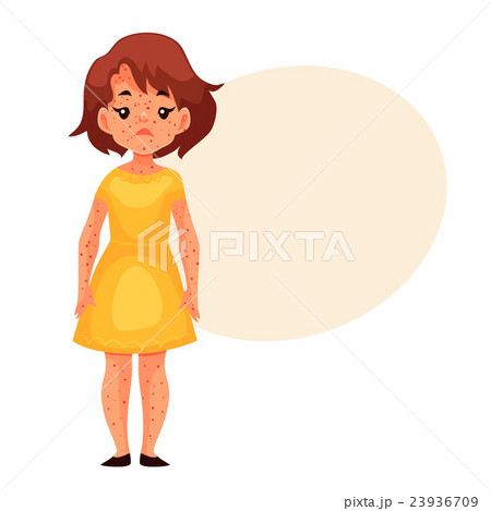 Little girl in yellow dress having chickenpox 23936709