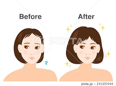 女性 悩み 薄毛 イラスト before after 女性 悩み 薄毛 イラスト before after 24105444