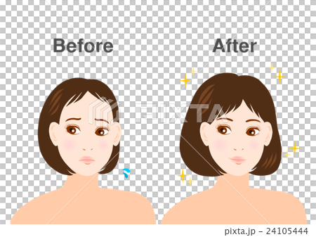 女性 悩み 薄毛 イラスト before after 女性 悩み 薄毛 イラスト before after 24105444