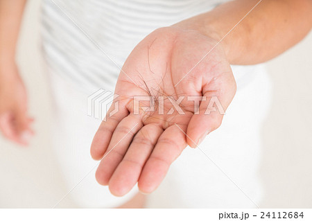 若い男性の抜け毛 24112684