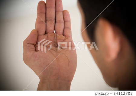 若い男性の抜け毛 24112705