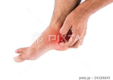 Athlete's foot 24189845