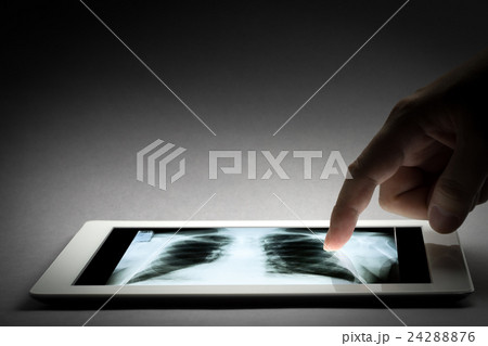 Human X-ray film exam by doctor 24288876