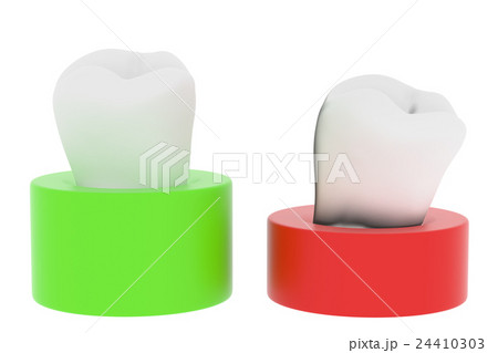 健康な歯、不健康な歯 24410303